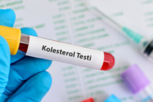 Yüksek kolesterol belirtileri nelerdir yüksek kolesterolü anlamanın yolları Yüksek kolesterol belirtileri nelerdir yüksek kolesterolü anlamanın yolları