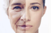 Mezolifting nedir? Mezoliftin amaçları nelerdir? Mezolifting nedir? Mezoliftin amaçları nelerdir?