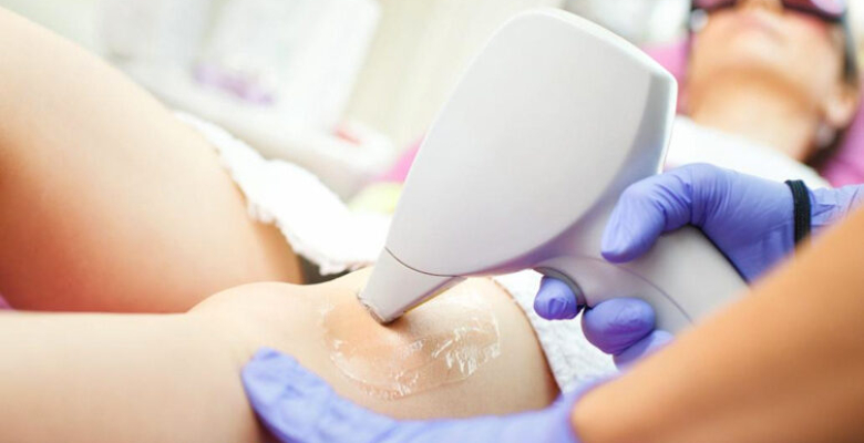 Lazer kısırlık yapar mı koltuk altı lazer uygulaması lenf bezlerini etkiler mi? Lazer kısırlık yapar mı koltuk altı lazer uygulaması lenf bezlerini etkiler mi?